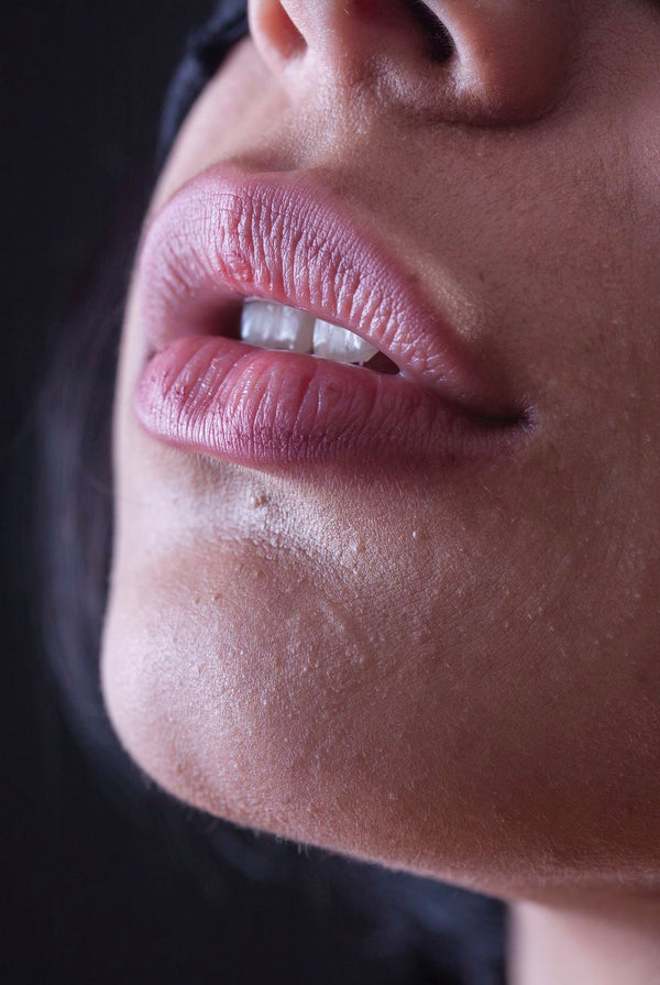 Vitamin E for Chapped and Dry Lips